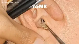 Asmr ear cleaning in vietnam barber shop (#Tóc_Công_Sở_Hà_Tĩnh 35)