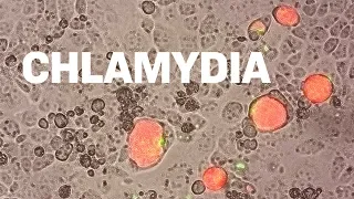 Fluorescing Parasites | Researching Chlamydia