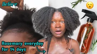 I’M still shocked ! I used rosemary on my hair everyday for 2 weeks and this happened