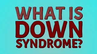 What is Down Syndrome? Down syndrome (trisomy 21)