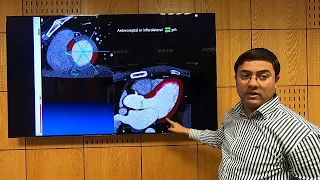 Day 1 Cardiac CT full Anatomy