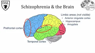 Tricky Topics: Causes of Schizophrenia