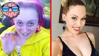 Top 10 MOST SHOCKING Before and After Drug Use Photos