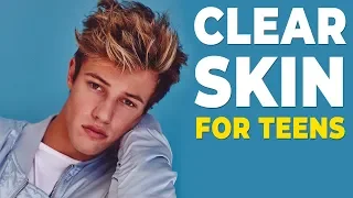 How To GET RID OF ACNE for Teens | Clear Skin FAST 2020 | Alex Costa