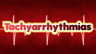 Tachyarrhythmias (updated 2023) - CRASH! Medical Review Series