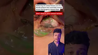 NEVER SLEEP WITH YOUR CONTACT LENSES🤯😨 #shorts #mbbs #neet | Raj Bhosle