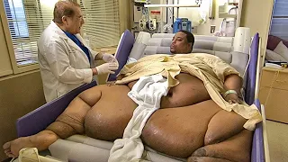 Can You Guess His Weight ? The Most Overweight People on The World