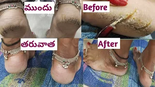 How to do pedicure in parlour style