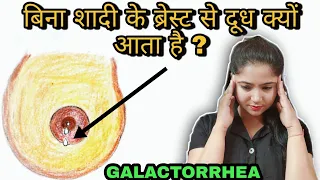 बिना शादी के ब्रेस्ट से दूध क्यों आता है ? Why does milk come from the breast without marriage ?