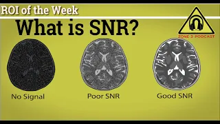 What is SNR? And Why is it so Important? One of MRI most important Metric "SNR" Explained