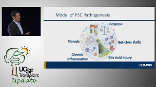 New Frontiers in the Management of PSC