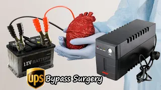 How to Upgrade UPS with a Bypass Surgery | UPS Modification | Easily Make 12v Battery Charger