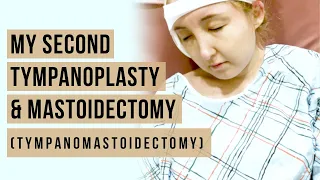 My Second Tympanoplasty and Mastoidectomy (Tympanomastoidectomy)