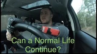 Amputee: CAN A NORMAL LIFE EXIST WITH A BIONIC ARM??