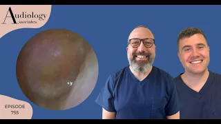 AWESOME EARDRUM PEEL/FUNGAL INFECTION DEBRIS REMOVAL - EP755