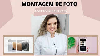 MONTAGEM DE FOTO - ANTES & DEPOIS
