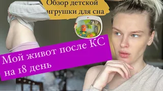 VLOG:МОЙ ЖИВОТ ПОСЛЕ КС/МОЯ СЕСТРА РОДИЛА/СЬЕЗДИЛА НА УЗИ ПОДРЕЗАТЬ ШОВ/ОБЗОР ДЕТСКОЙ КОЛЫБЕЛЬНОЙ