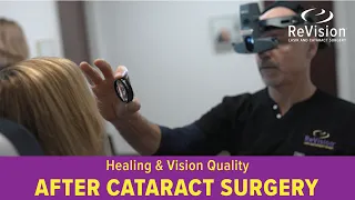 Recovery & Vision Expectations After Cataract Surgery