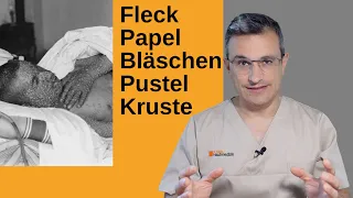 Affenpocken: Übertragung, Symptome, Impfung, Ansteckung mit dem Affenpockenvirus. Dr. Kasten, Mainz