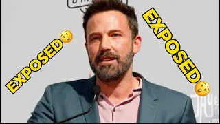 Ben Affleck's doctor exposes details behind his 'new face' 😲😲😲