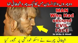 Man with two Faces : Mystery of Edward Mordake Solved دو منہ والا انسان