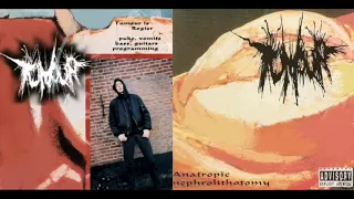 Tumour - Anatropic Nephrolithotomy [FULLALBUM - 2005]