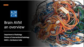 AVM intracranial an overview on current treatment options.