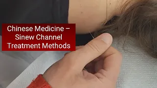 Chinese medicine - Sinew channel treatment methods