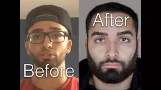NoFap | 2+ Year Update | The Truth