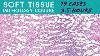 Soft Tissue Pathology Course: 19 Cases in 3.5 Hours (Oregon Pathologists Association 2021)
