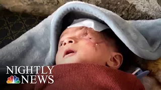 Syria’s Wounded Are Not The Only War Casualties | NBC Nightly News