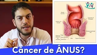 O que você sabe sobre o CÂNCER de ânus? | Dr. Marcelo Werneck