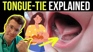 Doctor explains tongue tie in babies (ankyloglossia) - including treatment options!