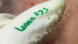 Satisfying With Loan Nguyen Spa Video #057