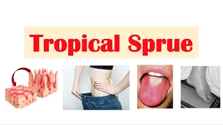 Tropical Sprue | Causes, Pathogenesis, Signs & Symptoms, Diagnosis, Treatment