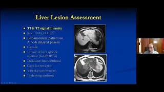 ISG MASTERCLASS I: (10)  IMAGING OF LIVER SOL