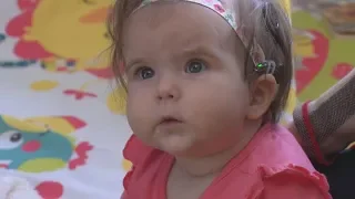 Baby hears for the first time thanks to cochlear implants