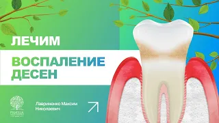 👨‍⚕️ Как лечить воспаление десен?