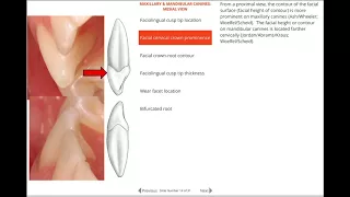 Comparison Between Permanent Maxillary And Mandibular Canine