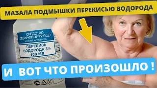 Мазала подмышки перекисью водорода и вот что произошло!