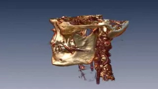 Amira | 3D visualization and analysis | 3D visualization of a head CT scan