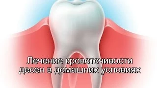 Лечение кровоточивости десен в домашних условиях