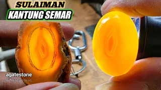 BATU CINCIN KANTUNG SEMAR ||  SULAIMAN JUNJUNG DERAJAT