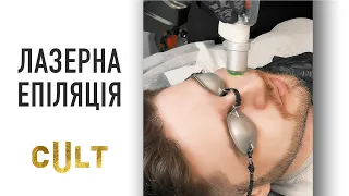 Лазерна Епіляція Обличчя Для Чоловіків | Barber Пакет | cUlt clinic | Київ