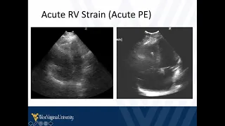 M4 Surgical Skills 2021 POCUS in Shock featuring the Heart and Lungs