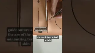 Simple interrupted Suture