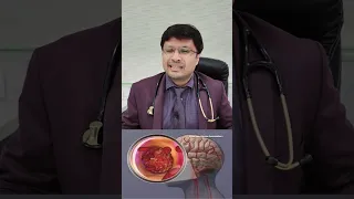 लकवे  के मरिजो /Stroke patients:- THROMBOLYSIS and it's role