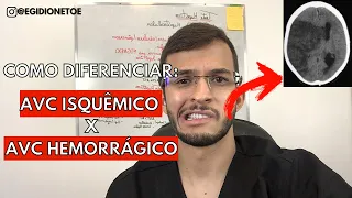 Como diferenciar um AVC isquêmico X AVC hemorrágico - EGÍDIO NETO