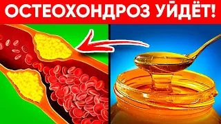 Остеохондроз Пропал За Ночь! Это Лекарство Может Сделать Каждый! (Невероятный Эффект!)