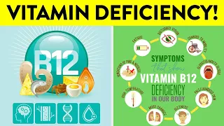 Vitamin B12 Deficiency Symptoms and Treatment | Cure Anemia | Ataxia | Memory loss and Confusion